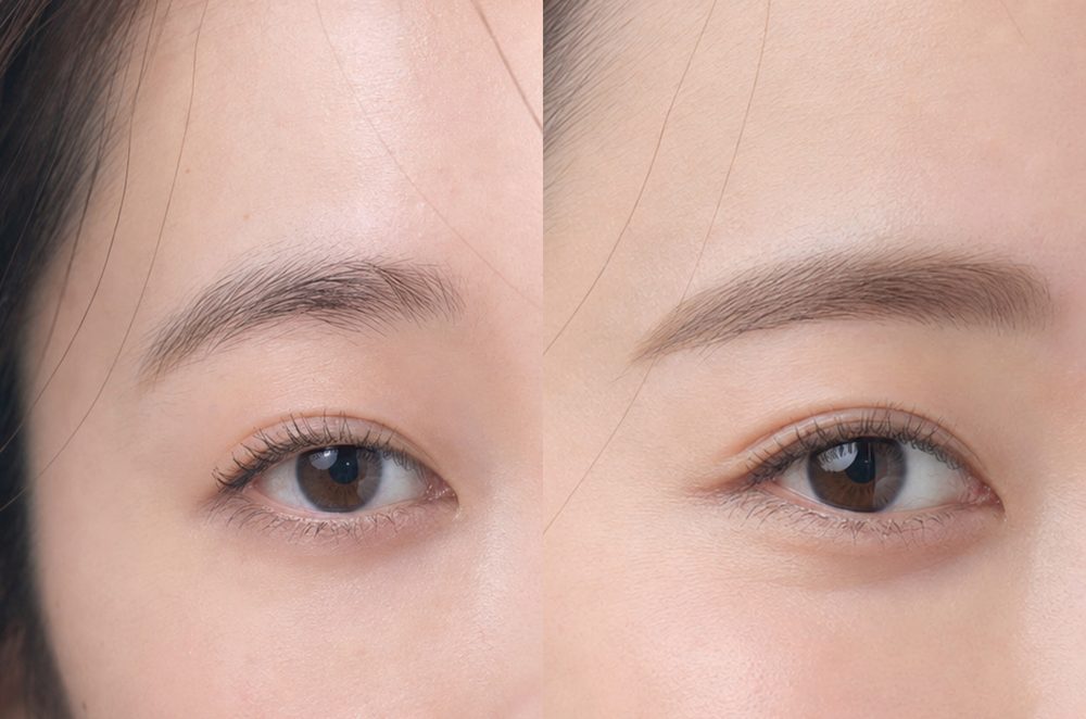 眉毛デザインのビフォーアフター:左右差を整えて印象を均一に