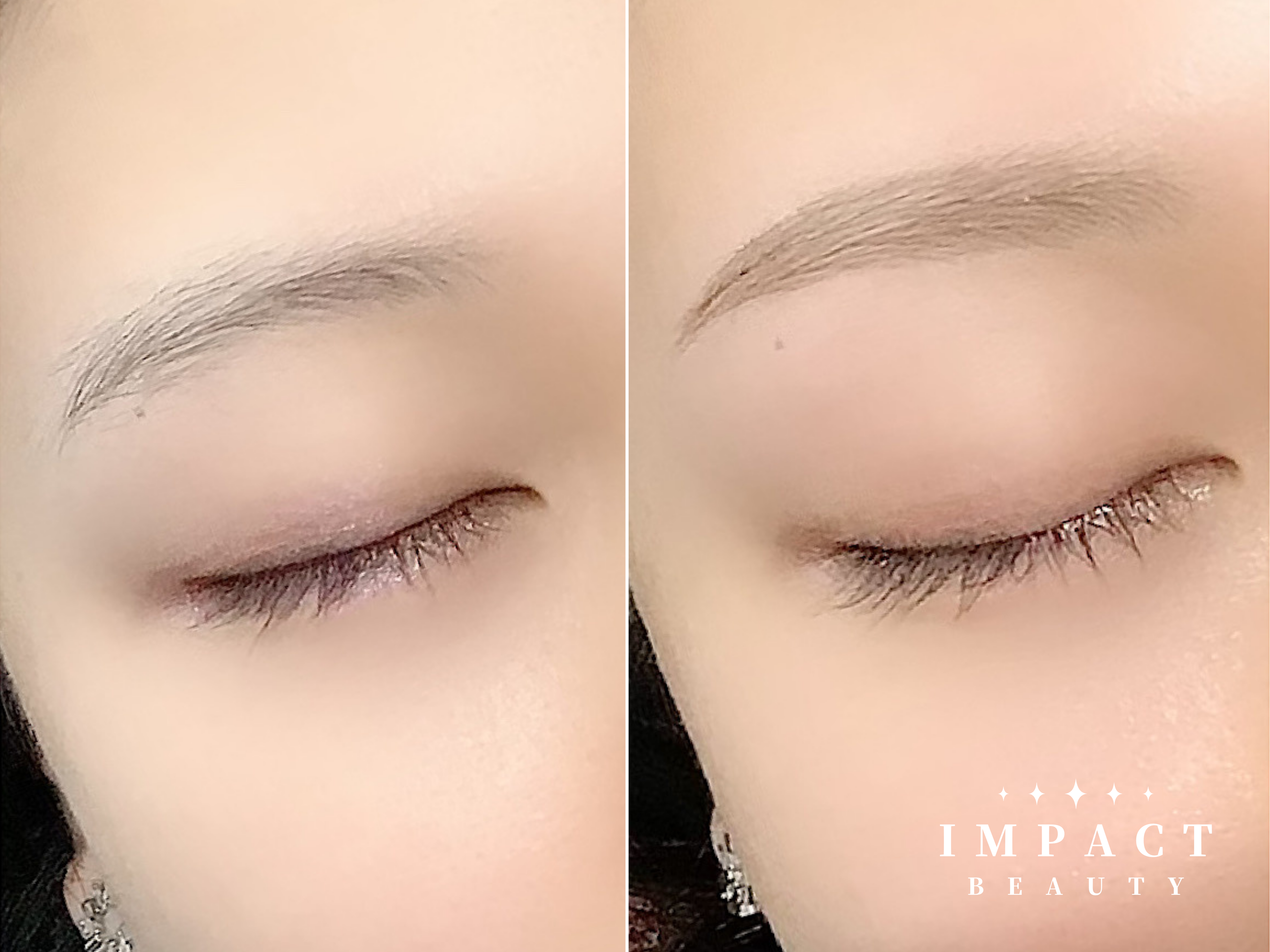 ビフォーアフター 03